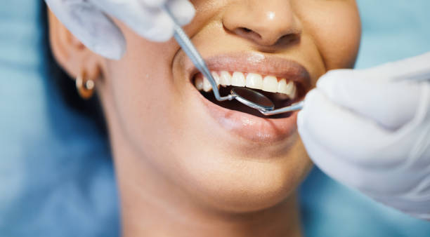 Best Dental Abscess Treatment in Pleasanton, KS